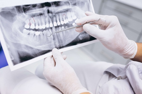 Compreenda o que faz um cirurgião bucomaxilofacial Compreenda o que faz um cirurgião bucomaxilofacial